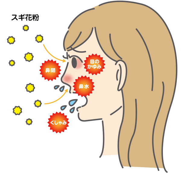 スギ花粉症もアレルギー疾患 舌の下 したのした で行う鳥居薬品の舌下免疫療法専門サイト